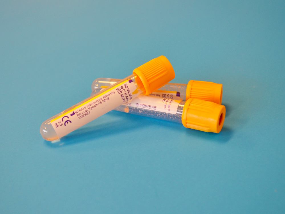 When Should I Get a Health Screening in Singapore?